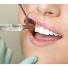 Почему возникает боязнь стоматологических процедур