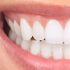 Лечение клиновидного дефекта зубов